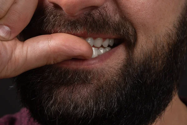 Labbra maschili con barba non tagliata in primo piano. Primo piano della parte maschile del viso. L'uomo si morde le unghie. Cattive abitudini. — Foto Stock
