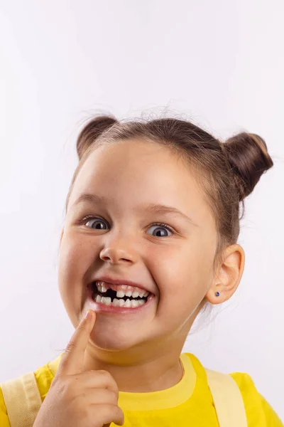 Pretty girl with opened mouth pointing at missing front milk tooth with finger smiling crazily and looking at camera on white background. First teeth changing going to dentist to do tooth treatment — Zdjęcie stockowe