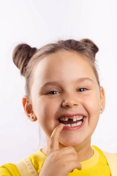 Weibliches süßes Kind mit geöffnetem Mund, das den fehlenden Vorderzahn zeigt, mit dem Finger auf der Unterlippe lächelnd in gelbem T-Shirt auf weißem Hintergrund. Erste Zähne wechseln. Zum Zahnarzt gehen, um eine Zahnbehandlung zu machen Stockfoto