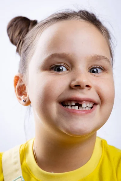 Маленькая девочка улыбается с открытым ртом, показывая отсутствующий передний молочный зуб в желтой футболке на белом фоне. Первые зубы меняются. Собираюсь к стоматологу для лечения зубов — стоковое фото