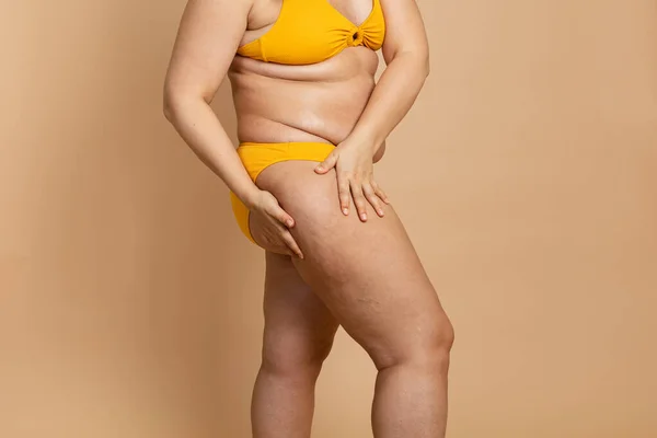 Foto recortada do corpo da mulher excesso de pele laranja em maiô amarelo, tratamento da obesidade celulite nos quadris, nádegas — Fotografia de Stock