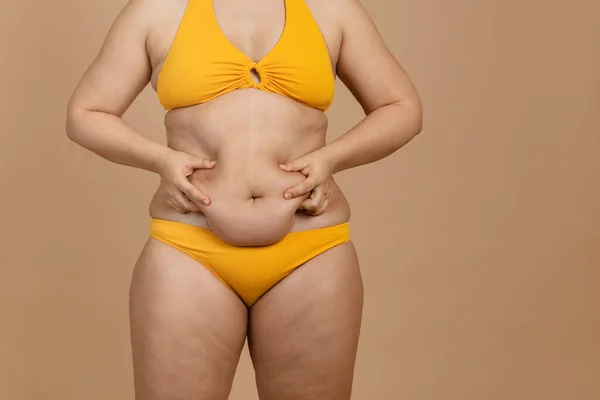 Przycięty obraz otyłej kobiety z otyłością, nadmiar tłuszczu w żółtym stroju kąpielowym. Samoakceptacja, ciało pozytywne — Zdjęcie stockowe