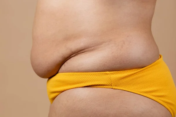 Cropped image of overweight fat pregnant woman sag stomach with obesity, excess fat in yellow pants. Fast weight loss.
