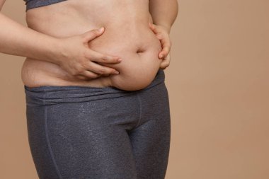 Ekstra kilolu, taytlı bir kadının göbeğini sıkan elleri ön tarafta. Vücut pozitif. Hücre esnekliği ihlali, besin kaybı. Hamilelikten sonra sarkık deri ya da ani kilo kaybı
