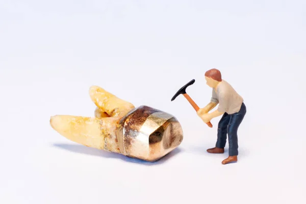 Closeup Miniature People Working Gold Tooth — Stock Photo, Image