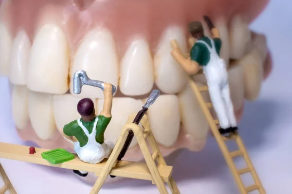 Primer Plano Personas Miniatura Reparando Una Dentadura Postiza —  Fotos de Stock
