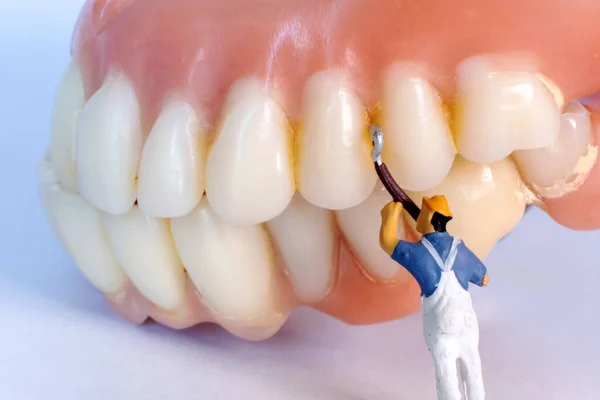 Closeup Miniature People Repairing Denture — Stock Photo, Image