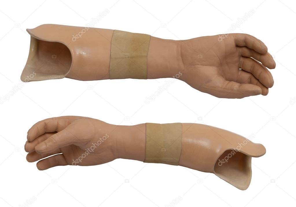 Prosthetic arm