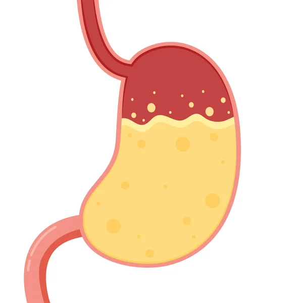 胃のアイコン 臓器のシンボルだ ベクトルはフラットです 胃食道逆流症の概念 胃の酸の完全な人間の胃 カットビュー 平型ベクトルイラスト — ストックベクタ