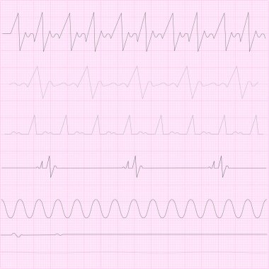 Kardiyogram kağıdı. Kalp atışı ikonu. Kalp atışı. Kardiyoloji uzmanı. Tıp konsepti. Vektör çizimi. Resim yükle. 