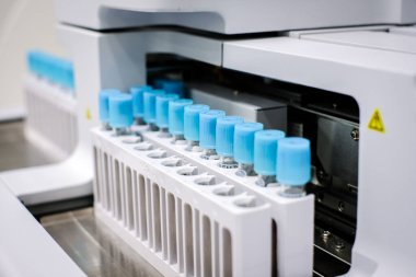 Laboratuvarda Coronavirus Covid-19 testi. Tıbbi tarama ve Covid üretimi test ediyor. Dikkati dağılmış. Yüksek kalite fotoğraf