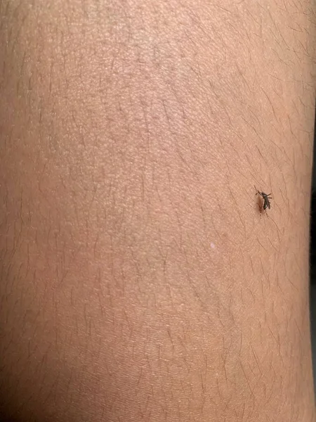 Mosquito Human Skin — Stock Photo, Image
