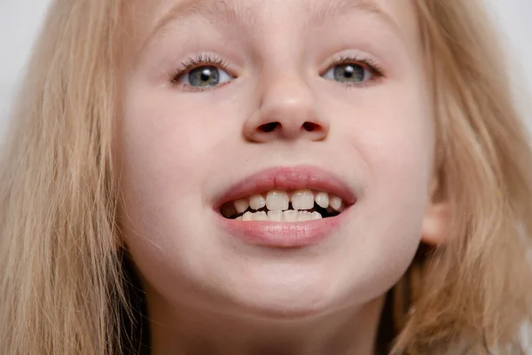 Girl shows teeth with a gap, malocclusion, blonde