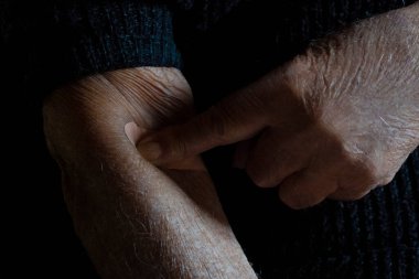 Yaşlı bir adam (91 yaşında) evdeki kan naklinden sonra alçıya baskı yapıyor. Ayrıntılı plan.