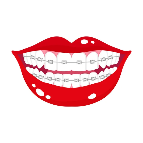 Dibujos Animados Vectoriales Sonriente Boca Con Etapas Alineación Los Dientes — Vector de stock