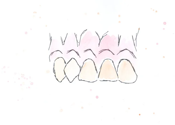 Teeth Row Dentistry Watercolor Art Decoration Sketch Illustration Hand Drawn — Stock Photo, Image