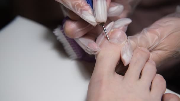 Podiatry. Removing calluses with a scalpel at the beautician.Podiatrist treating feet during procedure.Professional hardware pedicure using electric machine. — Stock Video