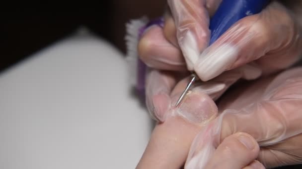 La podología. Eliminación de callos con un bisturí en el esteticista.Podólogo tratando los pies durante el procedimiento.Pedicura de hardware profesional utilizando una máquina eléctrica. — Vídeo de stock