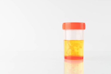 Laboratuvarda kan örneği şişesi (hematuria) bulundu. Hematüriye idrar yolu enfeksiyonu, böbrek enfeksiyonu, mesane taşı, prostatit veya kanser neden olmuş..