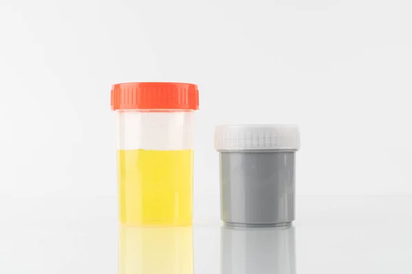 Sampel Urin Warna Kuning Dan Botol Spesimen Kontainer Stool Untuk — Stok Foto