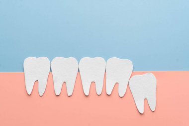 Yirmi yaş dişleri ile kağıttan yapılmış sağlıklı diş karikatürleri. Yirmilik dişler ile ilgili diş sorunları diş çürümesi, çene ağrısı, ağız enfeksiyonu veya sakız hastalığıdır. Yaratıcı fikir.