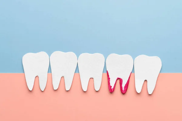 White Teeth Bleeding Cartoon Made Paper Bleeding Gums Sign Gingivitis — Stock Photo, Image