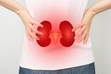 Bel ağrısı ve böbrek anatomisi olan bir kadın. Yan ağrılar arasında idrar yolu enfeksiyonu, böbrek enfeksiyonu, böbrek taşı, yaralanma ya da böbrek kanseri yer alıyor. Nefroloji kavramı.