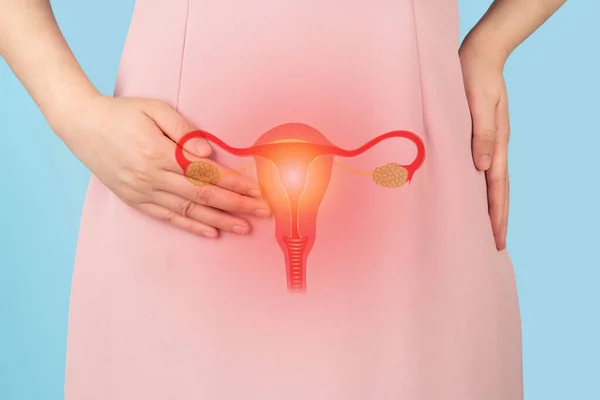 Woman suffering from pelvic pain with uterus and ovaries anatomy. Cause of pain inclued dysmenorrhea, edometriosis, PCOS, PMS, STDs, gynecologic cancer. Reproductive system and woman health problems.