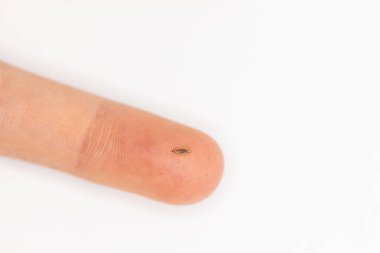 Bir çocuğun saçında bit bulunduğunda parmağında bit olan bir insan.