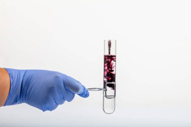 Siyah reaksiyonlu test tüpü ve yakın plan pipet. Elinde test tüpünde renkli sıvı var. Cam pipetten test tüpüne siyah sıvı damlası, beyaz üzerinde izole edilmiş. .