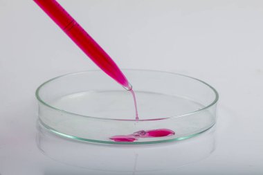 Kırmızı biyolojik analiz çözeltisiyle petri kabının üzerine kırmızı sıvı damlatılan laboratuvar pipeti bir bilim araştırma laboratuvarında biyoteknoloji deneyi için enfekte olmuş bakteriler tarafından kirletilmiş..