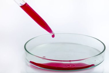 Kırmızı biyolojik analiz çözeltisiyle petri kabının üzerine kırmızı sıvı damlatılan laboratuvar pipeti bir bilim araştırma laboratuvarında biyoteknoloji deneyi için enfekte olmuş bakteriler tarafından kirletilmiş..