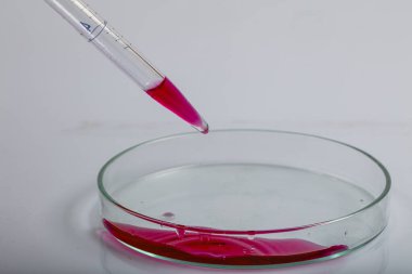 Kırmızı biyolojik analiz çözeltisiyle petri kabının üzerine kırmızı sıvı damlatılan laboratuvar pipeti bir bilim araştırma laboratuvarında biyoteknoloji deneyi için enfekte olmuş bakteriler tarafından kirletilmiş..