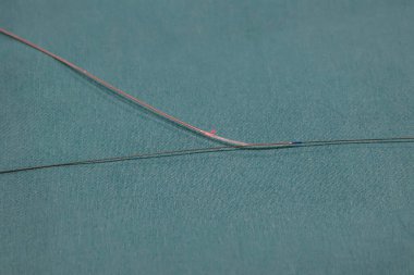 Optik eşkenar tomografi (OCT) çapraz ve boylamsal görünümde koroner arterin ölçümünü yapılmıştır..