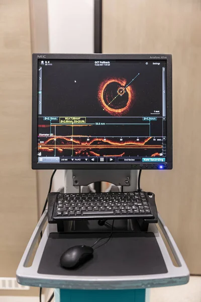 Istanbul Turkey September 2022 Optical Coherence Tomography Oct Performed Measurement — Stock Photo, Image