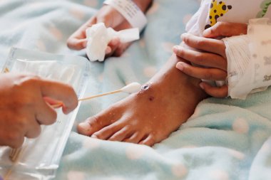 Hastanedeki özel hasta odalarında kalırken annesinin hasta kızının temizlik yapmasına ve yarasına ilaç koymasına yardım etmesini kapat. Sağlık ve yaşam tarzı kavramı.