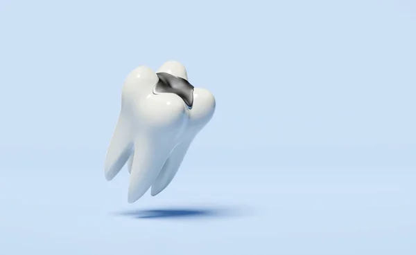 青色の背景に隔離された充填材料と3D歯科用モル歯モデルのアイコン 歯医者の歯科検査白い歯の健康3Dレンダリングイラスト — ストック写真