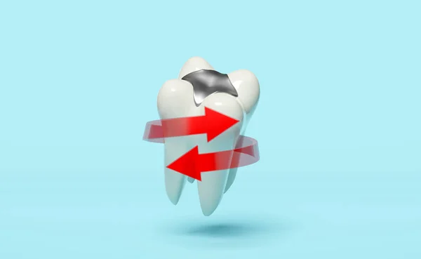歯のモル歯は 青色の背景に隔離された材料を充填 赤いスパイラル矢印と3Dアイコンをモデル化します 歯医者の歯科検査歯の保護3Dレンダリングイラスト — ストック写真