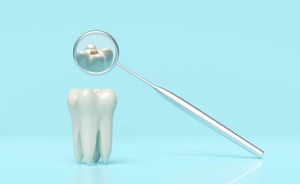 歯科用モル歯モデルのアイコンは 青の背景に隔離された歯科用ミラー付きキャビティ3Dをチェックします 白い歯の健康 歯医者の歯科検査 3Dレンダリングイラスト — ストック写真