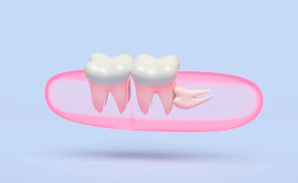 Dental Examination Dentist Wisdom Teeth Model Problems Icon Gums Isolated — ストック写真