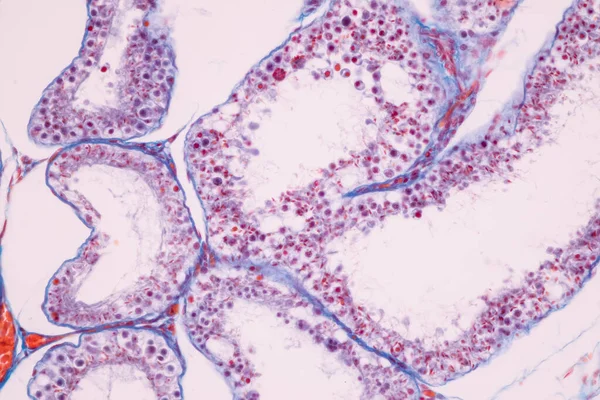Anatomie Histologische Eierstokken Testis Menselijke Cellen Onder Microscoop — Stockfoto