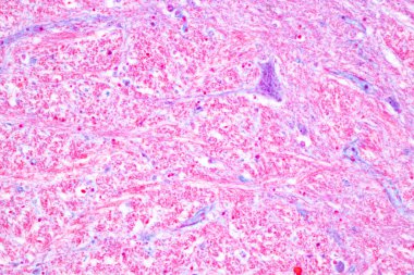 Beyincik, Thalamus, Medulla oblongata, omurilik ve Motor Nöron insan laboratuvarda mikroskop altında.