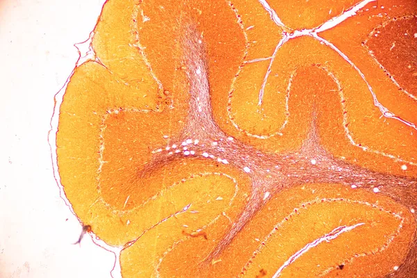 Cerebellum Thalamus Medulla Oblongata Spinal Cord Motor Neuron Human Microscope — стокове фото