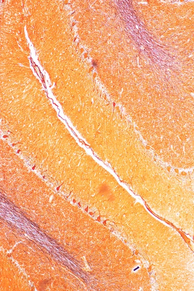 Cerebello Talamo Midollo Allungato Midollo Spinale Neurone Motorio Umano Microscopio — Foto Stock