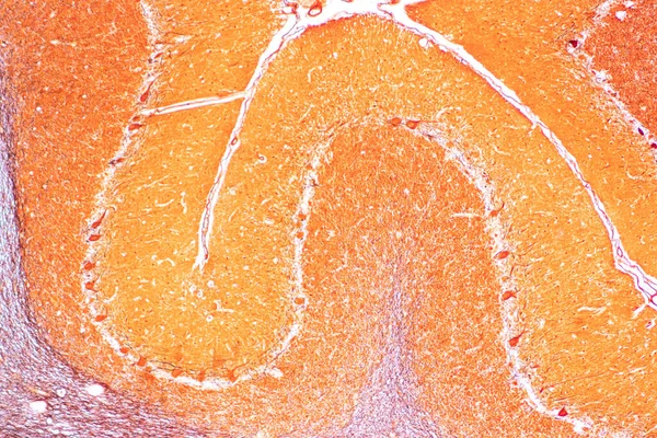 实验室显微镜下小脑 扁桃体 脊髓和运动神经元的研究 — 图库照片