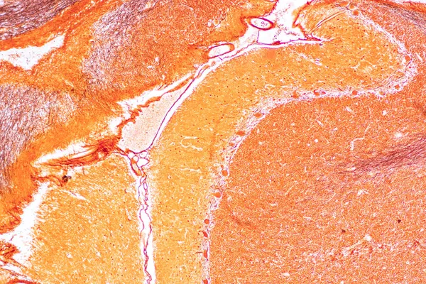 Cerebellum Thalamus Medulla Oblongata Medula Espinhal Neurônio Motor Humano Sob — Fotografia de Stock