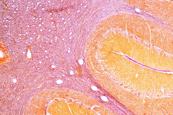 Церебеллум Таламус Продолговатая Медулла Спинной Мозг Двигательный Нейрон Человека Микроскопом — стоковое фото