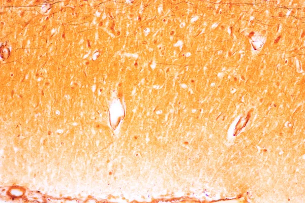 Cerebellum Thalamus Medulla Oblongata Spinal Cord Motor Neuron Human Microscope — стокове фото