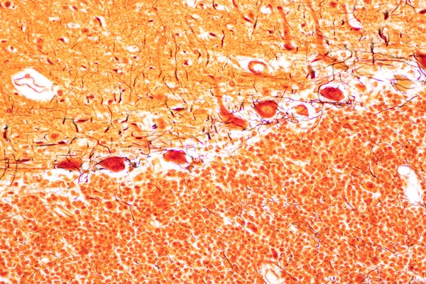 Beyincik Thalamus Medulla Oblongata Omurilik Motor Nöron Insan Laboratuvarda Mikroskop — Stok fotoğraf