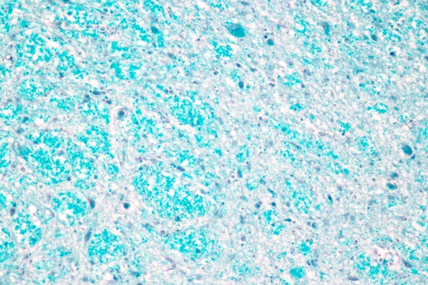 Cerebello Talamo Midollo Allungato Midollo Spinale Neurone Motorio Umano Microscopio — Foto Stock